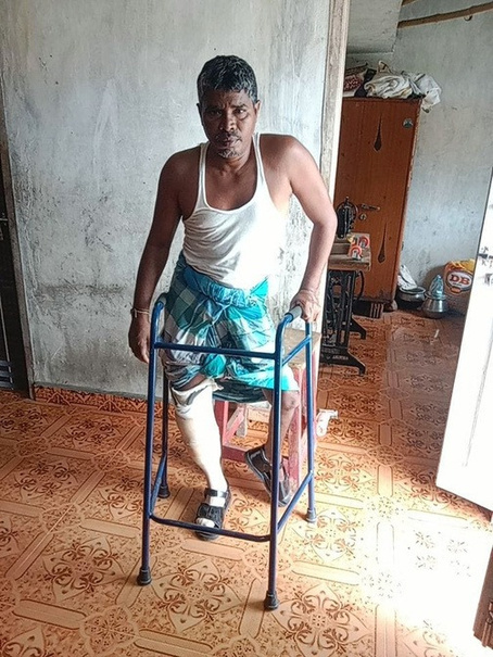 Artificial Legs - 2024 β presentation photograph 8